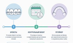 Исправление прикуса у взрослых: особенности, сроки и реальные отзывы ортодонтов