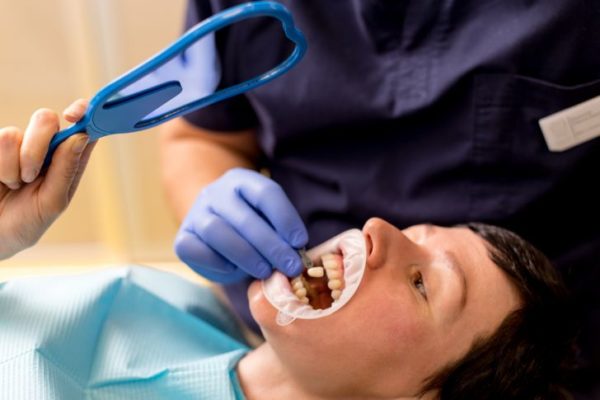 Процедура протезирования зубов