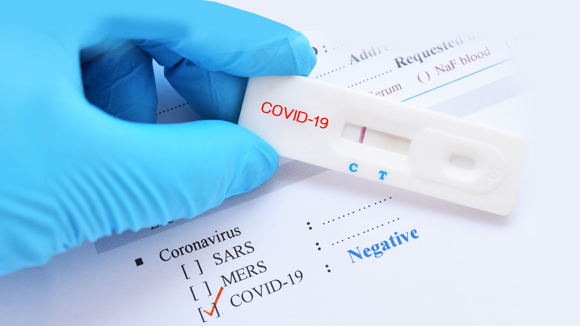 Тест на covid 19. Тест. SARS cov 2 antigen экспресс тест. Тест на коронавирус картинка. Палочки для ПЦР теста на коронавирус.